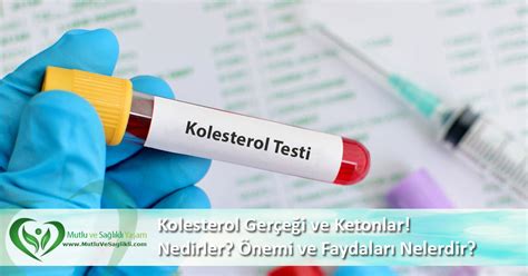 Apo B Nedir? Kolesterol Testlerindeki Önemi Ve Risk Değerlendirme ...